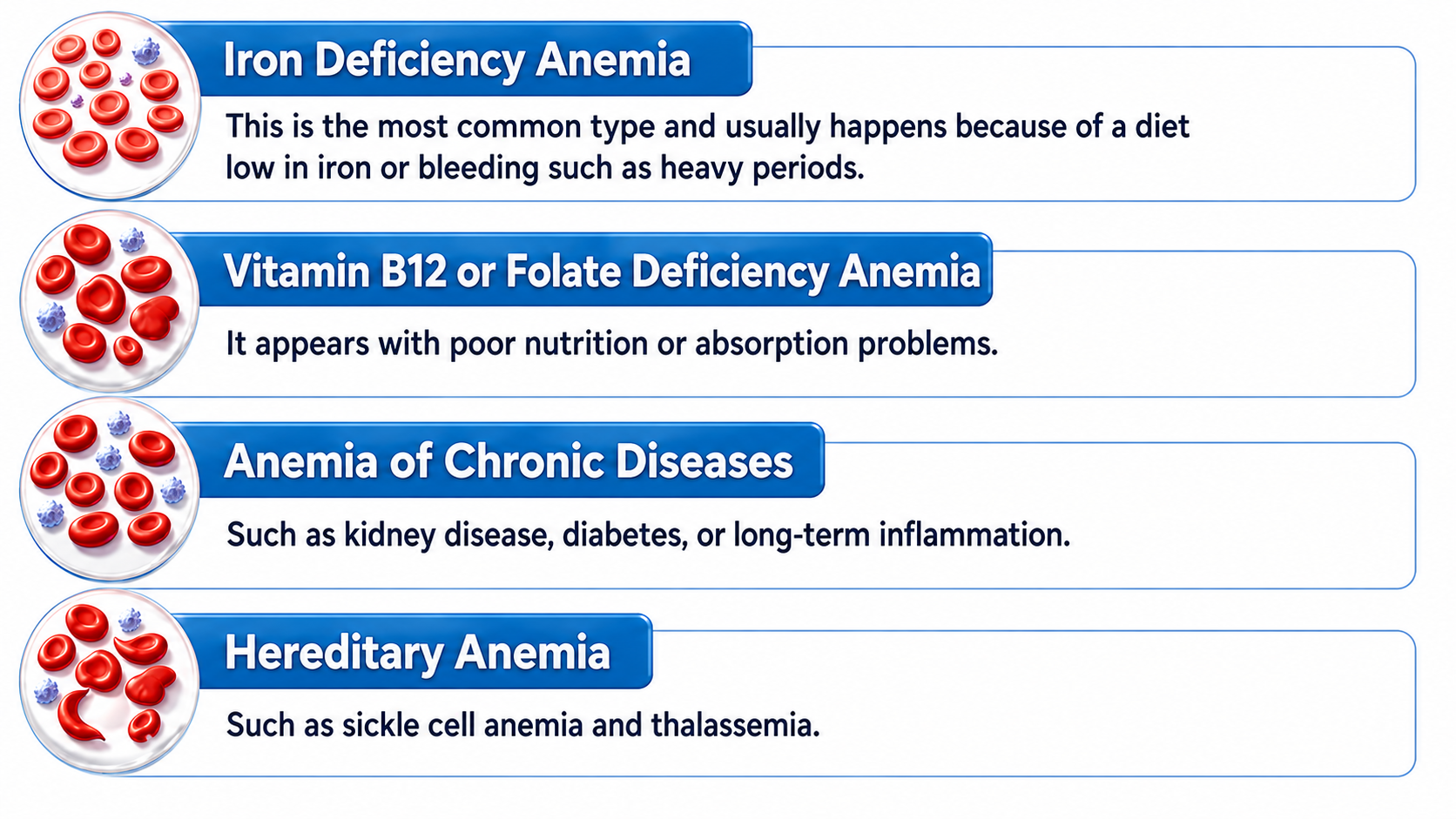 Infographic showing four common types of anemia with red blood cell illustrations: iron deficiency anemia, usually caused by low iron intake or bleeding such as heavy periods; vitamin B12 or folate deficiency anemia, linked to poor nutrition or absorption problems; anemia of chronic diseases, such as kidney disease, diabetes, or long-term inflammation; and hereditary anemia, such as sickle cell anemia and thalassemia.